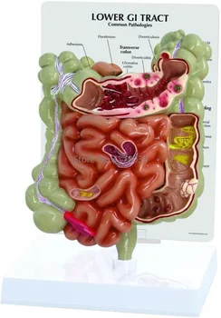Модель желудочно-кишечного тракта, модель нижней части желудочно-кишечного тракта, Анатомия человеческого тела, учебное пособие для врачей